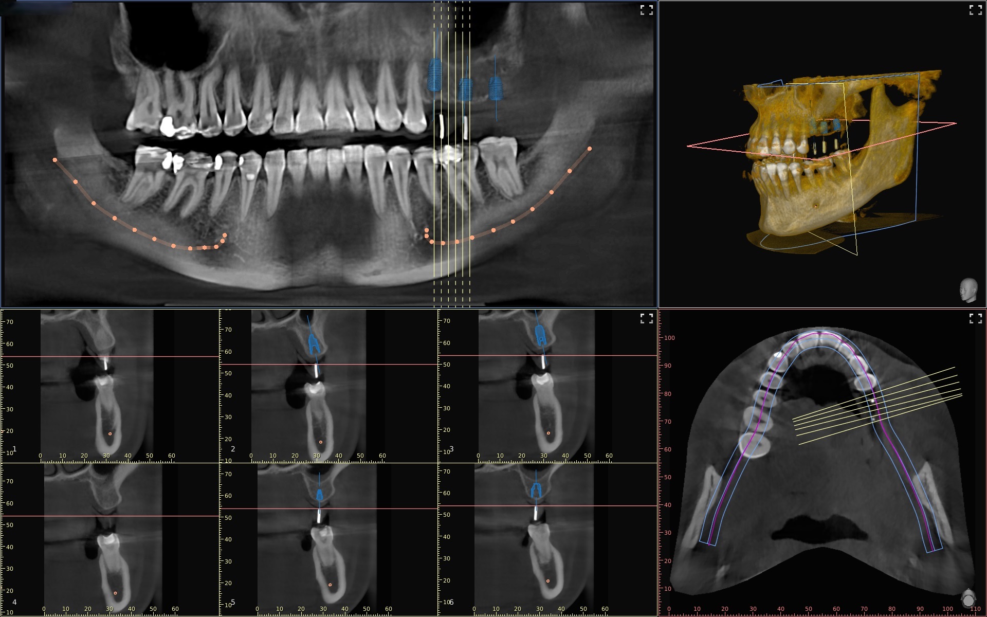 roentgen-dvt